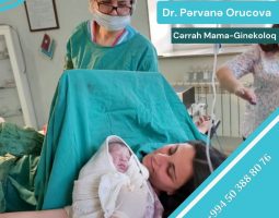 Cerrah Mama-Ginekoloq Pervane Orucova